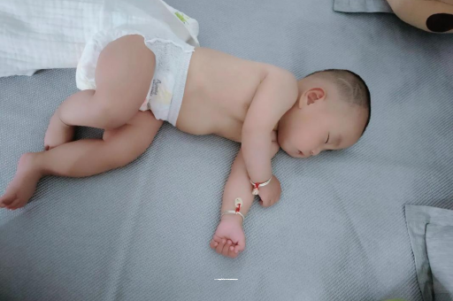 阳泉六个月宝宝眼睛散光